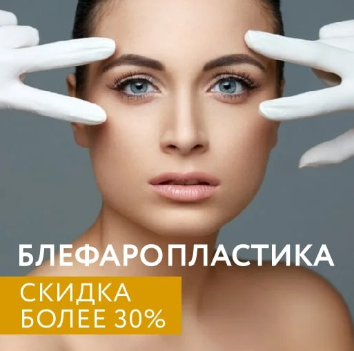 Блефаропластика
